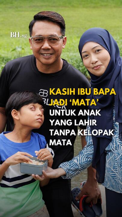 Kasih ibu bapa jadi ‘mata’ untuk anak yang lahir tanpa kelopak mata