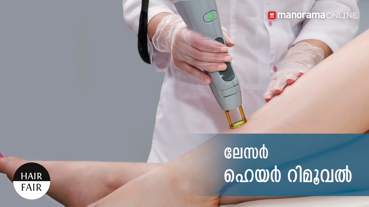 Things to know about Laser Hair Removal | Manorama Online